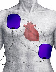 Defibrillateur